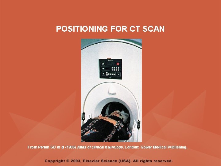POSITIONING FOR CT SCAN From Perkin GD et al (1986) Atlas of clinical neurology. POSITIONING FOR CT SCAN From Perkin GD et al (1986) Atlas of clinical neurology.