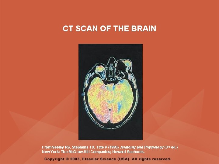 CT SCAN OF THE BRAIN From Seeley RS, Stephens TD, Tate P (1995) Anatomy CT SCAN OF THE BRAIN From Seeley RS, Stephens TD, Tate P (1995) Anatomy
