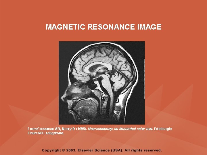MAGNETIC RESONANCE IMAGE From Crossman AR, Neary D (1995). Neuroanatomy: an illustrated color text. MAGNETIC RESONANCE IMAGE From Crossman AR, Neary D (1995). Neuroanatomy: an illustrated color text.