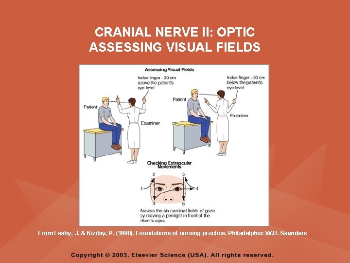 CRANIAL NERVE II: OPTIC ASSESSING VISUAL FIELDS From Leahy, J. & Kizilay, P. (1998). CRANIAL NERVE II: OPTIC ASSESSING VISUAL FIELDS From Leahy, J. & Kizilay, P. (1998).