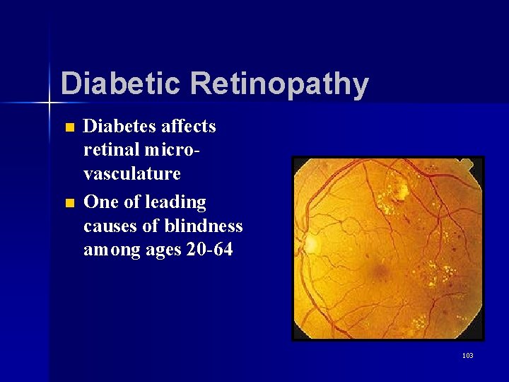 Diabetic Retinopathy n n Diabetes affects retinal microvasculature One of leading causes of blindness