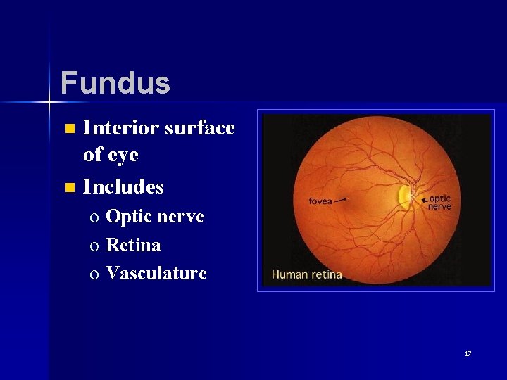 Fundus n n Interior surface of eye Includes o Optic nerve o Retina o