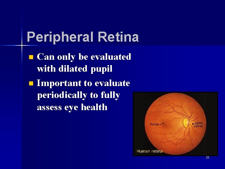 Peripheral Retina n n Can only be evaluated with dilated pupil Important to evaluate