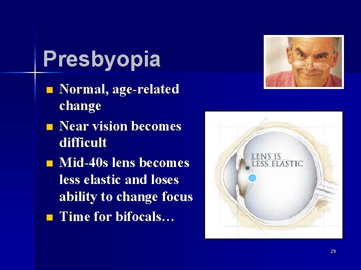 Presbyopia n n Normal, age-related change Near vision becomes difficult Mid-40 s lens becomes
