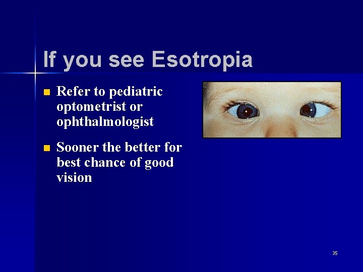 If you see Esotropia n Refer to pediatric optometrist or ophthalmologist n Sooner the