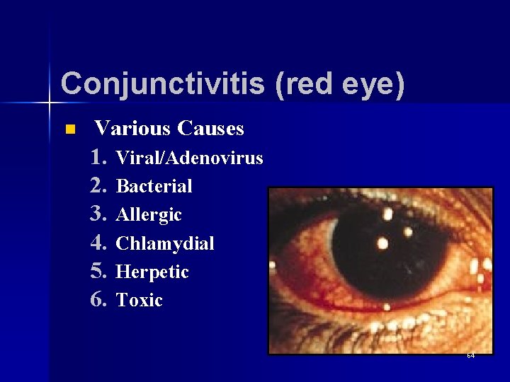 Conjunctivitis (red eye) n Various Causes 1. Viral/Adenovirus 2. Bacterial 3. Allergic 4. Chlamydial