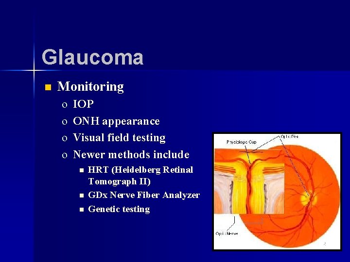 Glaucoma n Monitoring o o IOP ONH appearance Visual field testing Newer methods include