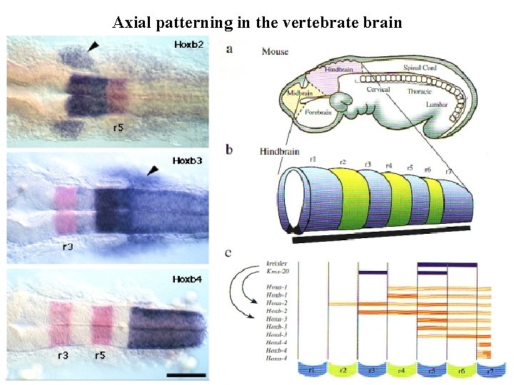 Axial patterning in the vertebrate brain 
