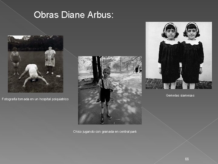 Obras Diane Arbus: Gemelas siamesas Fotografía tomada en un hospital psiquiatrico Chico jugando con