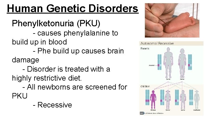 Human Genetic Disorders Phenylketonuria (PKU) - causes phenylalanine to build up in blood - Human Genetic Disorders Phenylketonuria (PKU) - causes phenylalanine to build up in blood -