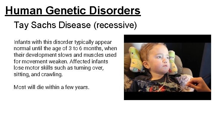 Human Genetic Disorders Tay Sachs Disease (recessive) Infants with this disorder typically appear normal Human Genetic Disorders Tay Sachs Disease (recessive) Infants with this disorder typically appear normal