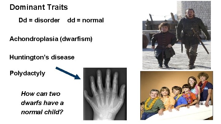 Dominant Traits Dd = disorder dd = normal Achondroplasia (dwarfism) Huntington’s disease Polydactyly How Dominant Traits Dd = disorder dd = normal Achondroplasia (dwarfism) Huntington’s disease Polydactyly How
