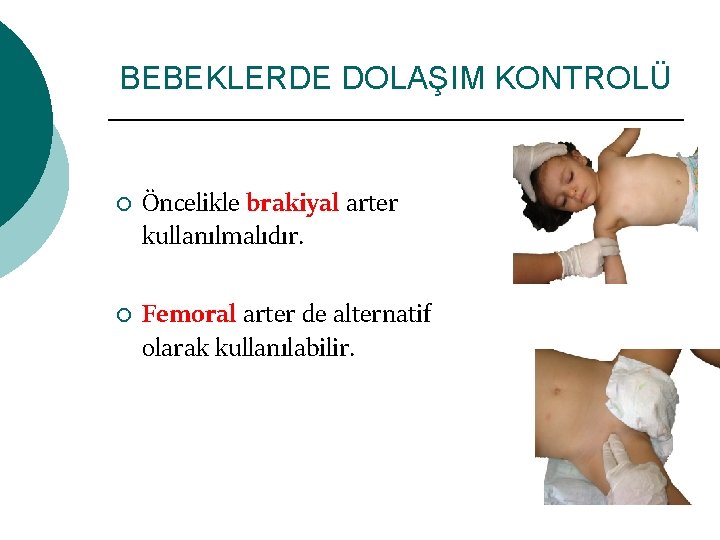 BEBEKLERDE DOLAŞIM KONTROLÜ ¡ ¡ Öncelikle brakiyal arter kullanılmalıdır. Femoral arter de alternatif olarak