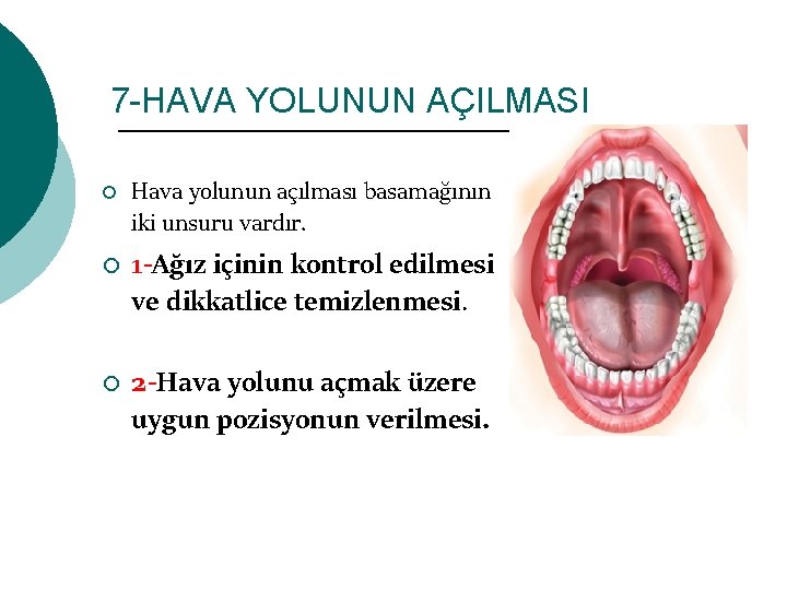 7 -HAVA YOLUNUN AÇILMASI ¡ ¡ ¡ Hava yolunun açılması basamağının iki unsuru vardır.