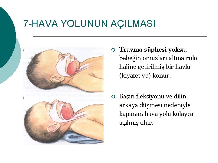 7 -HAVA YOLUNUN AÇILMASI ¡ ¡ Travma şüphesi yoksa, bebeğin omuzları altına rulo haline