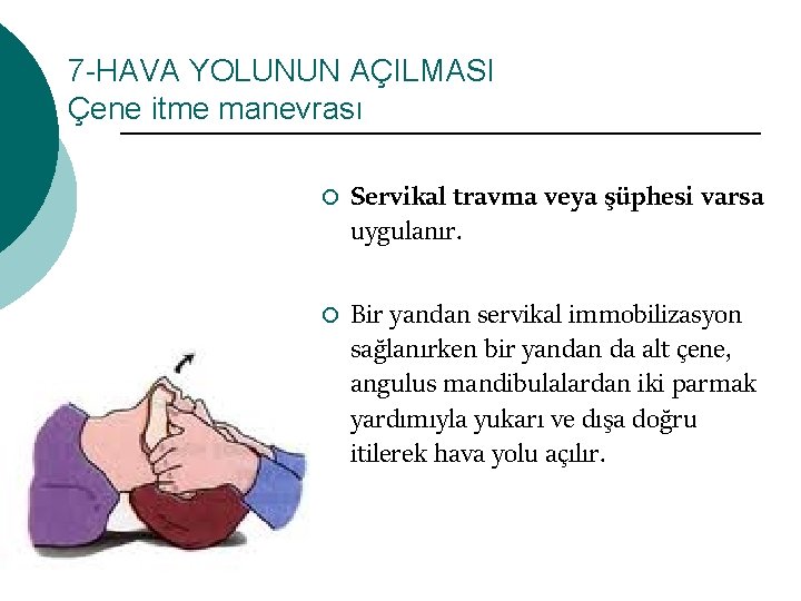 7 -HAVA YOLUNUN AÇILMASI Çene itme manevrası ¡ ¡ Servikal travma veya şüphesi varsa