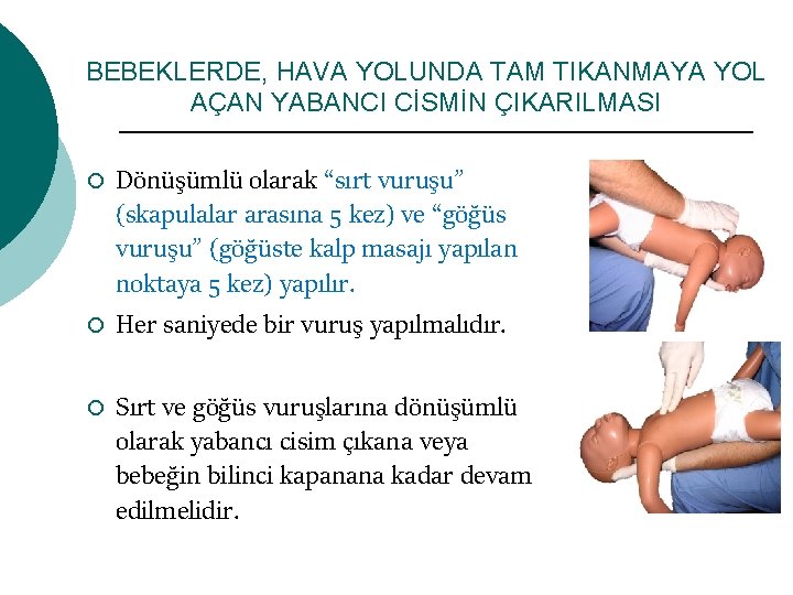 BEBEKLERDE, HAVA YOLUNDA TAM TIKANMAYA YOL AÇAN YABANCI CİSMİN ÇIKARILMASI ¡ ¡ ¡ Dönüşümlü
