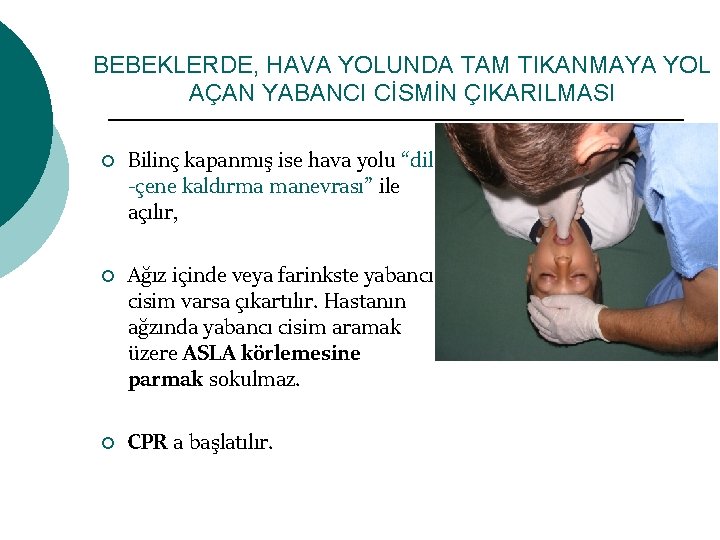 BEBEKLERDE, HAVA YOLUNDA TAM TIKANMAYA YOL AÇAN YABANCI CİSMİN ÇIKARILMASI ¡ ¡ ¡ Bilinç
