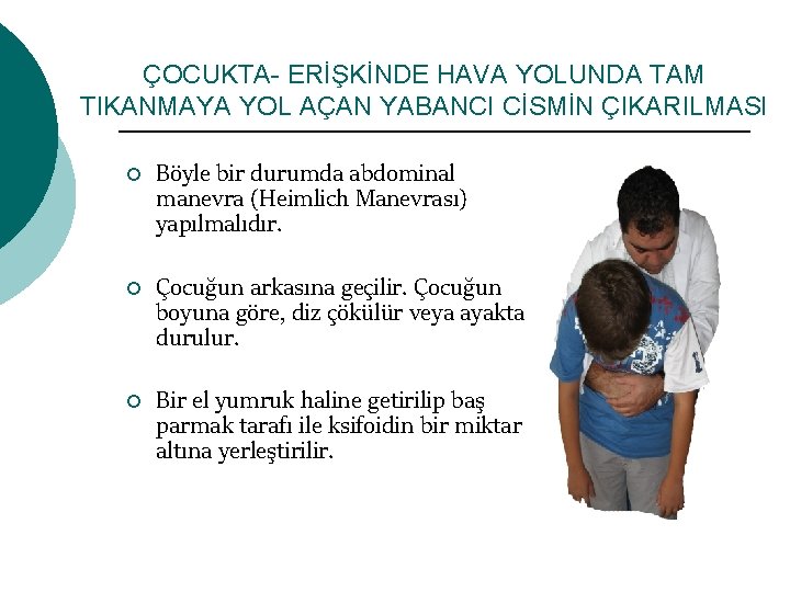 ÇOCUKTA- ERİŞKİNDE HAVA YOLUNDA TAM TIKANMAYA YOL AÇAN YABANCI CİSMİN ÇIKARILMASI ¡ ¡ ¡