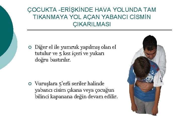 ÇOCUKTA -ERİŞKİNDE HAVA YOLUNDA TAM TIKANMAYA YOL AÇAN YABANCI CİSMİN ÇIKARILMASI ¡ ¡ Diğer