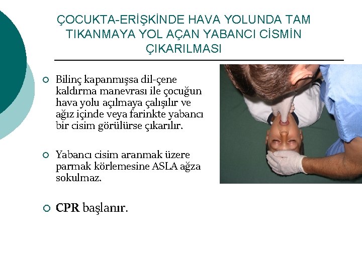 ÇOCUKTA-ERİŞKİNDE HAVA YOLUNDA TAM TIKANMAYA YOL AÇAN YABANCI CİSMİN ÇIKARILMASI ¡ ¡ ¡ Bilinç
