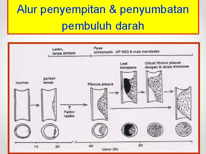 Alur penyempitan & penyumbatan pembuluh darah 