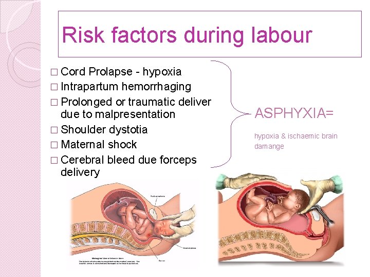 Risk factors during labour � Cord Prolapse - hypoxia � Intrapartum hemorrhaging � Prolonged