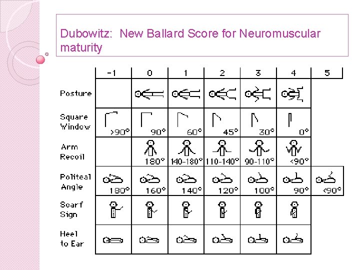 Dubowitz: New Ballard Score for Neuromuscular maturity 