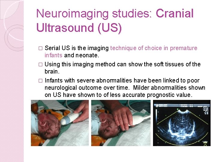 Neuroimaging studies: Cranial Ultrasound (US) Serial US is the imaging technique of choice in