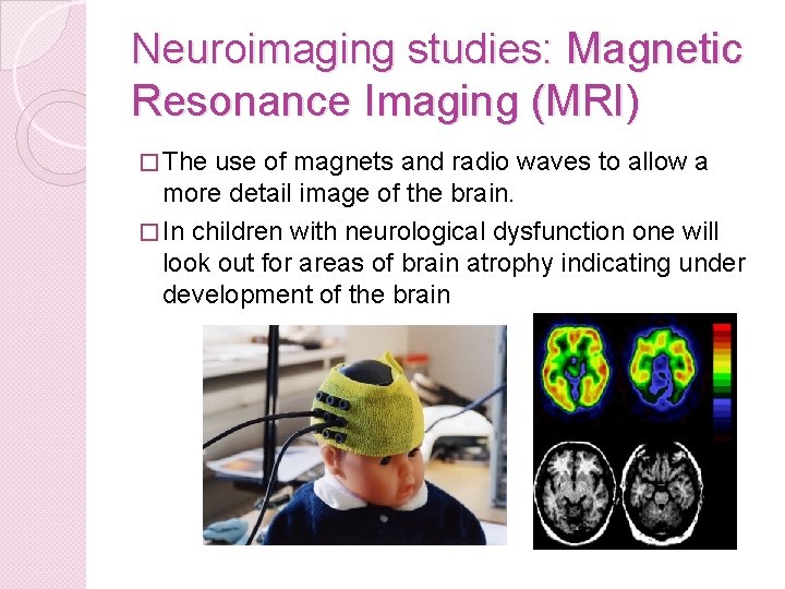 Neuroimaging studies: Magnetic Resonance Imaging (MRI) � The use of magnets and radio waves