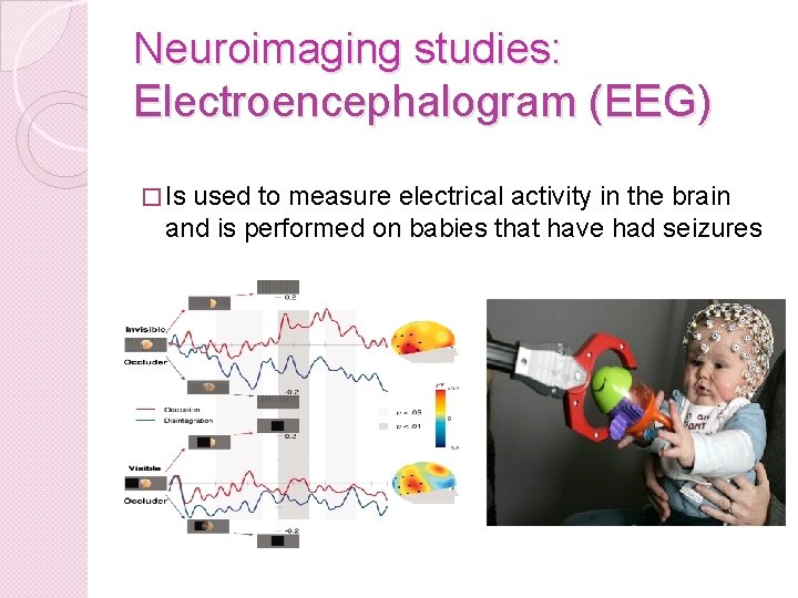 Neuroimaging studies: Electroencephalogram (EEG) � Is used to measure electrical activity in the brain