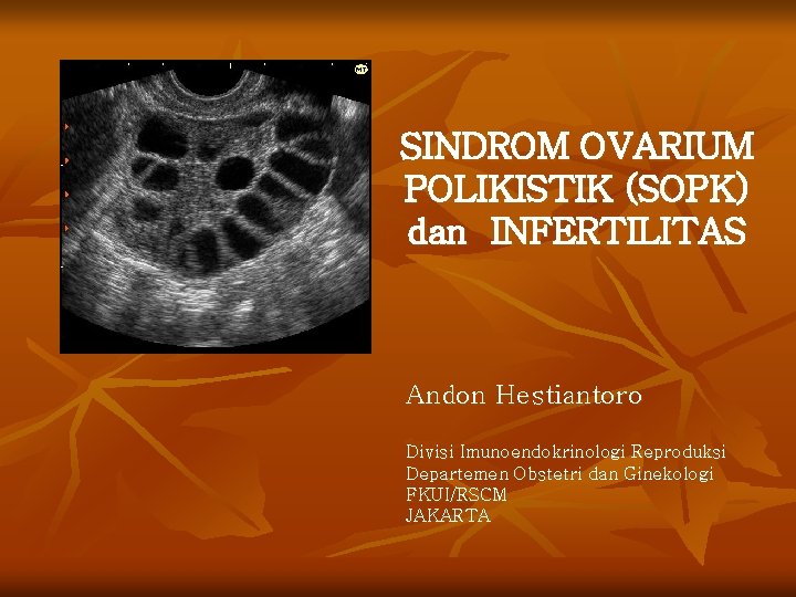 SINDROM OVARIUM POLIKISTIK (SOPK) dan INFERTILITAS Andon Hestiantoro Divisi Imunoendokrinologi Reproduksi Departemen Obstetri dan