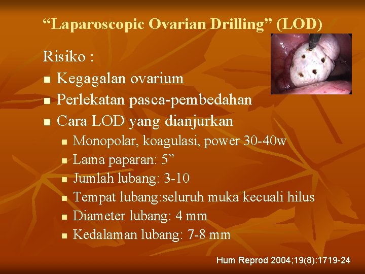 “Laparoscopic Ovarian Drilling” (LOD) Risiko : n Kegagalan ovarium n Perlekatan pasca-pembedahan n Cara