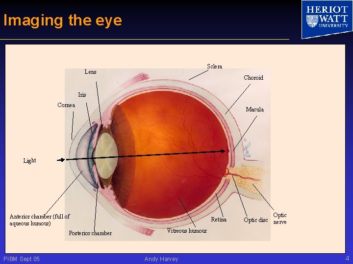 Imaging the eye Sclera Lens Choroid Iris Cornea Macula Light Anterior chamber (full of