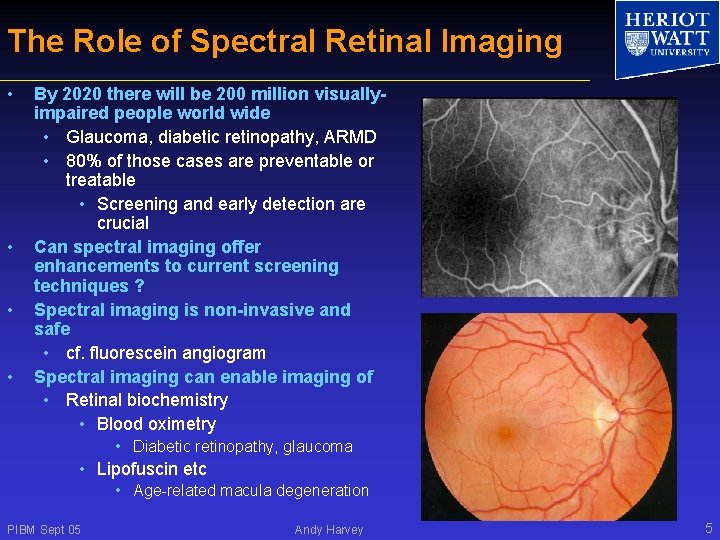 The Role of Spectral Retinal Imaging • • By 2020 there will be 200