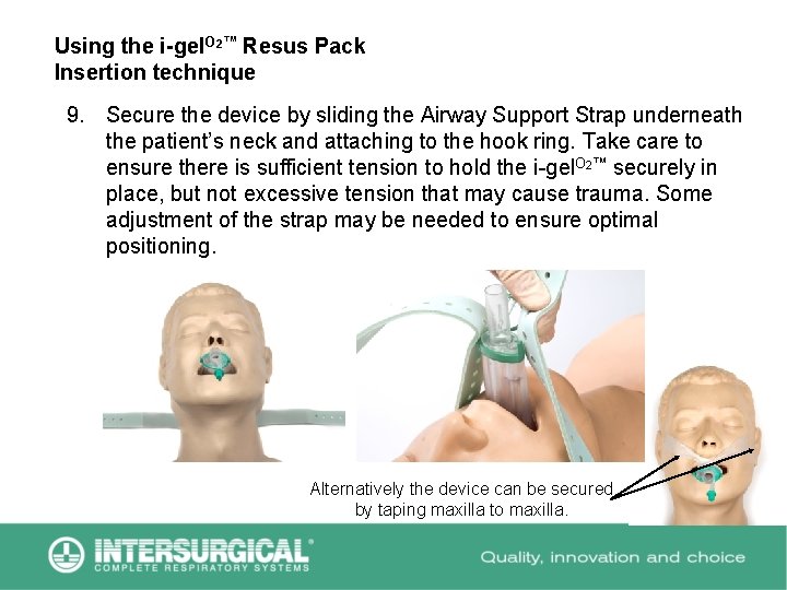 Using the i-gel. O 2™ Resus Pack Insertion technique 9. Secure the device by