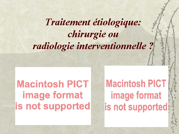 Traitement étiologique: chirurgie ou radiologie interventionnelle ? 