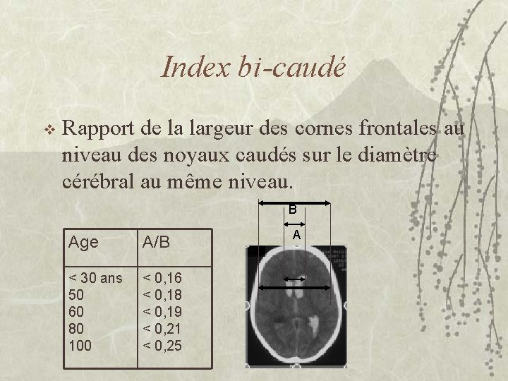 Index bi-caudé v Rapport de la largeur des cornes frontales au niveau des noyaux