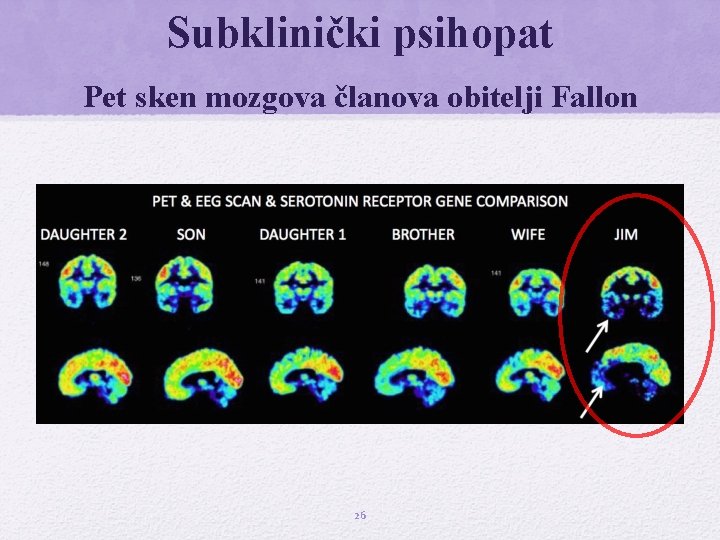 Subklinički psihopat Pet sken mozgova članova obitelji Fallon 26 