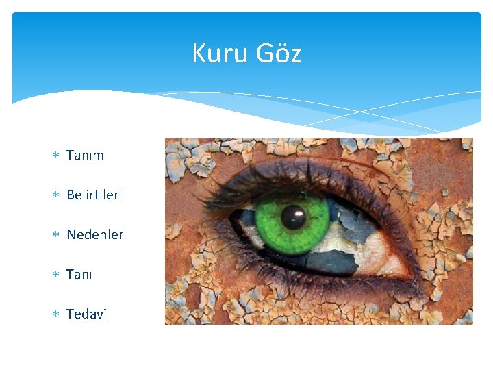 Kuru Göz Tanım Belirtileri Nedenleri Tanı Tedavi 