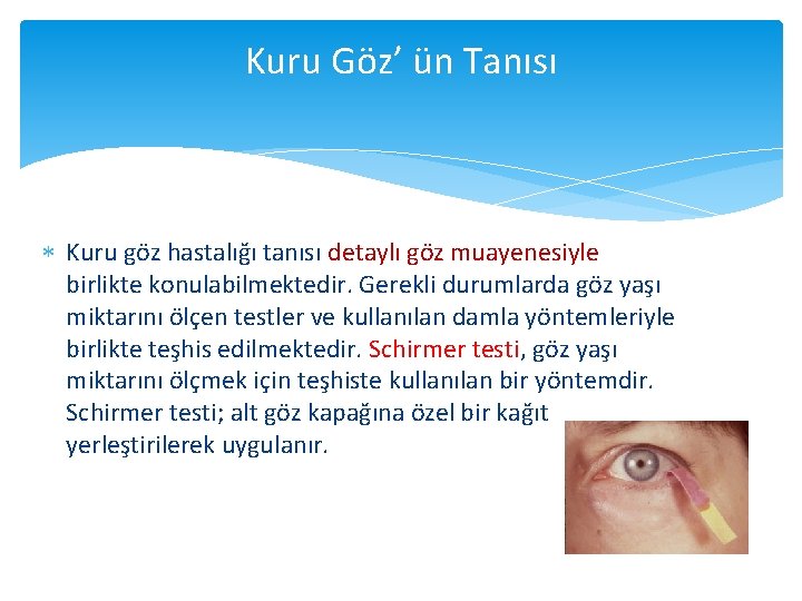 Kuru Göz’ ün Tanısı Kuru göz hastalığı tanısı detaylı göz muayenesiyle birlikte konulabilmektedir. Gerekli