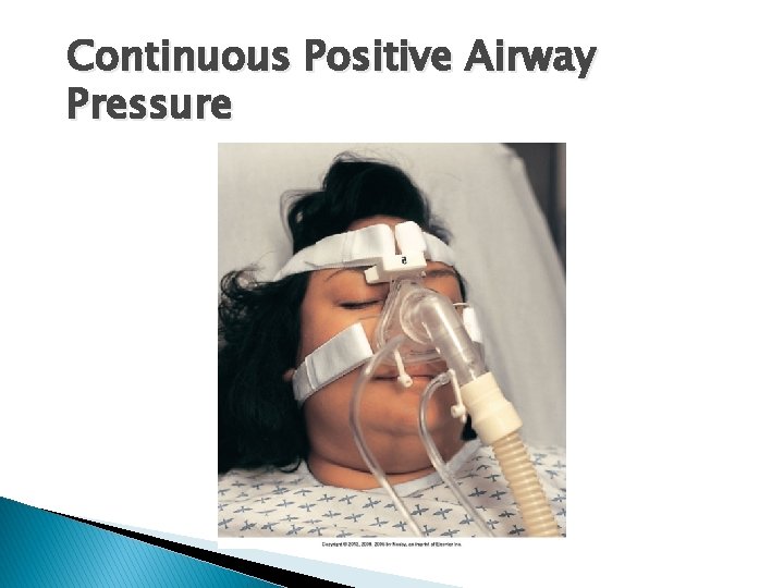 Continuous Positive Airway Pressure 