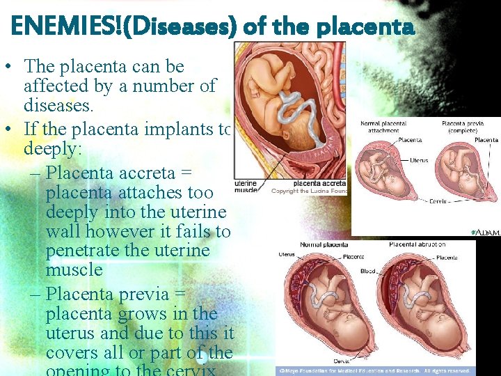ENEMIES!(Diseases) of the placenta • The placenta can be affected by a number of