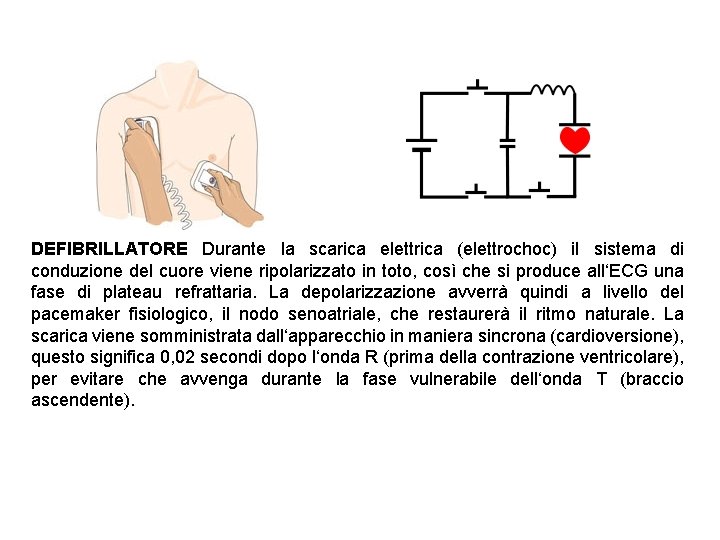 DEFIBRILLATORE Durante la scarica elettrica (elettrochoc) il sistema di conduzione del cuore viene ripolarizzato