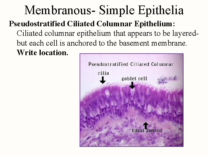 Membranous- Simple Epithelia Pseudostratified Ciliated Columnar Epithelium: Ciliated columnar epithelium that appears to be