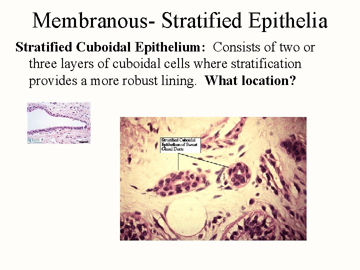 Membranous- Stratified Epithelia Stratified Cuboidal Epithelium: Consists of two or three layers of cuboidal