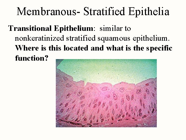 Membranous- Stratified Epithelia Transitional Epithelium: similar to nonkeratinized stratified squamous epithelium. Where is this