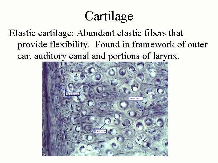 Cartilage Elastic cartilage: Abundant elastic fibers that provide flexibility. Found in framework of outer