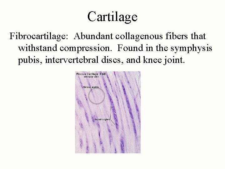 Cartilage Fibrocartilage: Abundant collagenous fibers that withstand compression. Found in the symphysis pubis, intervertebral