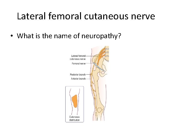 Lateral femoral cutaneous nerve • What is the name of neuropathy? Lateral femoral cutaneous nerve • What is the name of neuropathy?